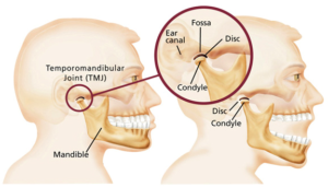 TMJ Treatment Melbourne
